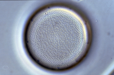 Actinocyclus ehrenb.var.crassa