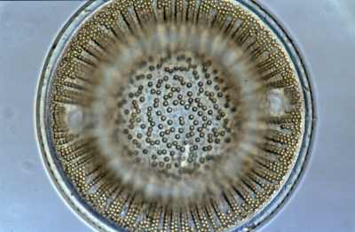 Actinocyclus ?