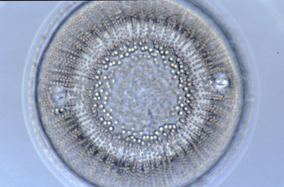 Actinocyclus ?
