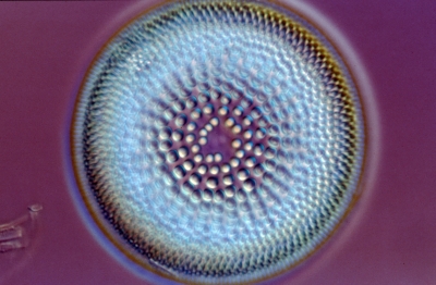 Actinocyclus spec.
