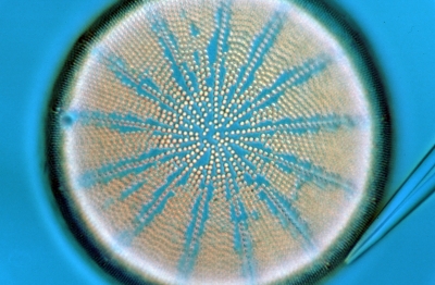 Actinocyclus spec.