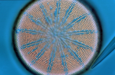 Actinocyclus spec.