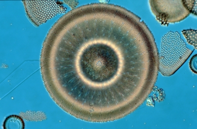 Actinocyclus