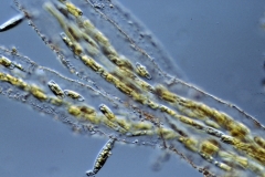 Amphipleura