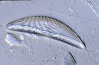 Amphora ovalis