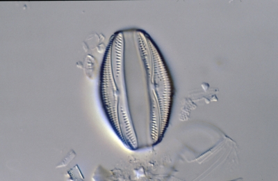 Amphora spec.