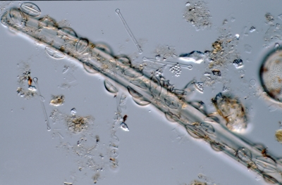Amphora pediculus