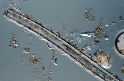 Amphora pediculus