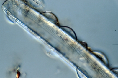 Amphora pediculus