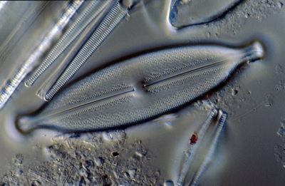 Anomoeoneis sphaerophora