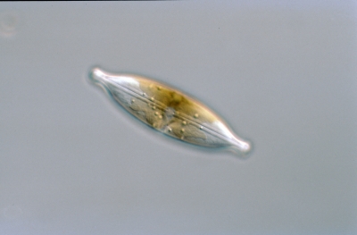 Anomoeoneis spaerophora