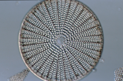 Arachnoidiscus spec.