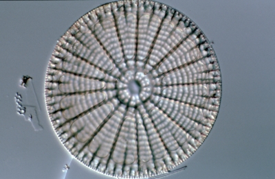 Arachnoidiscus