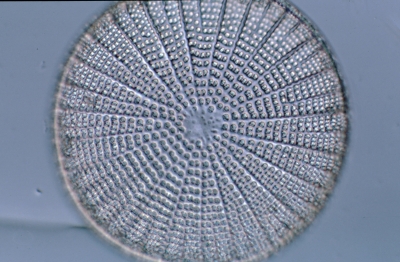 Arachnoidiscus