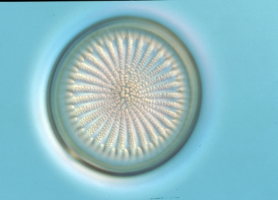 Arachnoidiscus?? spec.