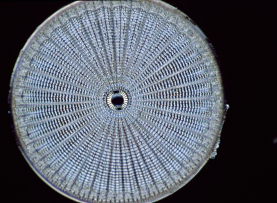 Arachnoidiscus