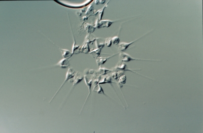 Asterionella glacialis