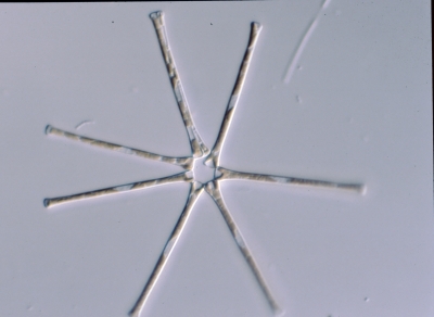 Asterionella formosa