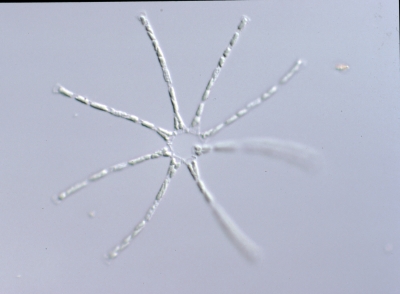 Asterionella f. varietas acaroide
