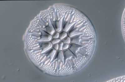 Asterolampra spec.