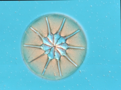 Asteromphalus