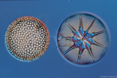 Asteromphalus / Coscinodiscus