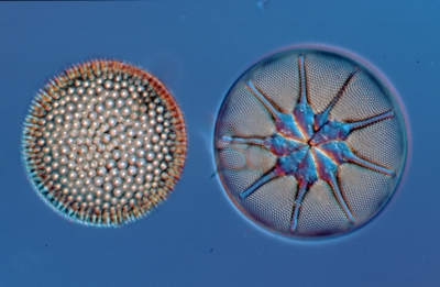 Asteromphalus/Coscinodiscus