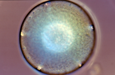 Aulacodiscus?