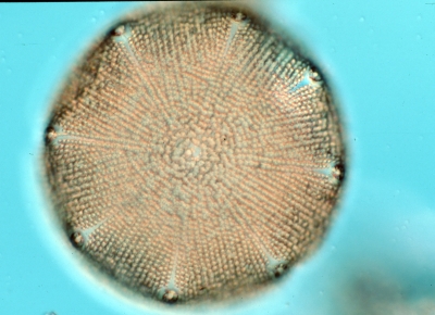 Aulacodiscus