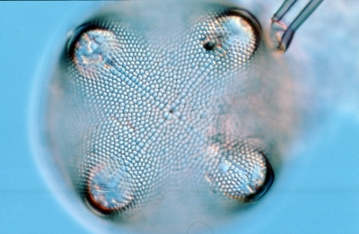Aulacodiscus