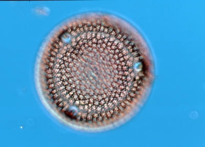 Aulacodiscus argus