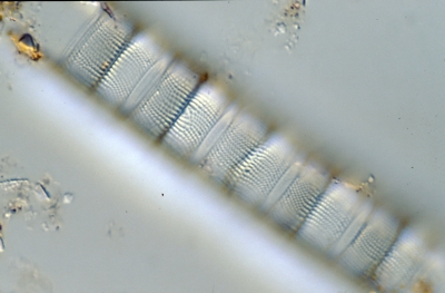 Aulacoseira muzzanensis