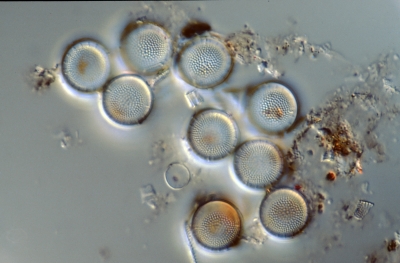 Aulacoseira spec.