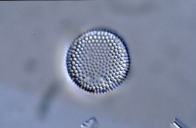 Aulacosira spec.