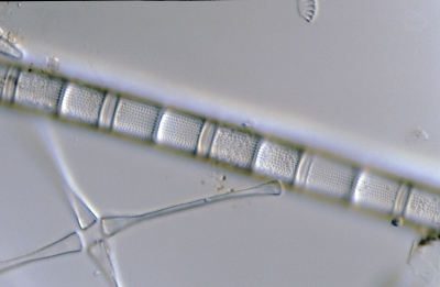 Aulacosira islandica?