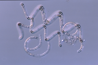 Aulacosira granulata