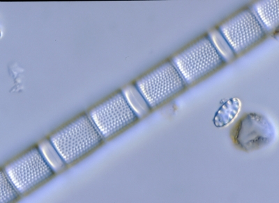 Aulacosira islandica f.helvetici