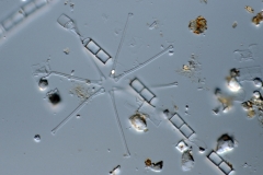 Aulacosira / Asterionella
