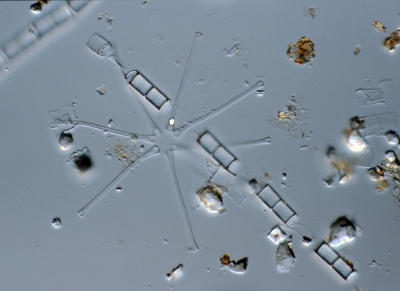 Aulacosira/Asterionella