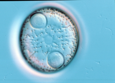 Auliscus
