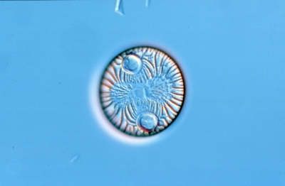 Auliscus caelatus v. strigillata