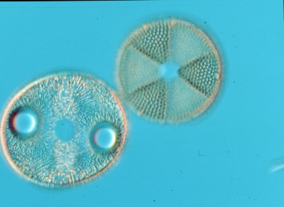 Auliscus/Actinoptychus