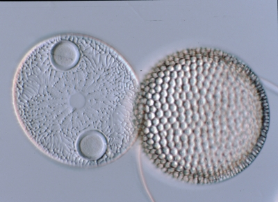 Auliscus/Coscinodiscus