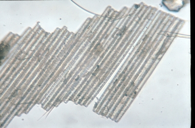 Bacillaria paradoxa