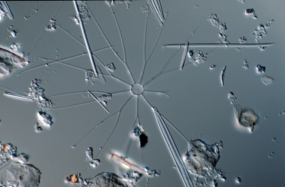 Bacteriastrum varians