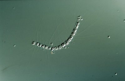 Bacteriastrum hyalinum?