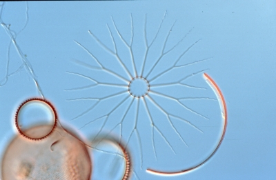 Bacteriastrum