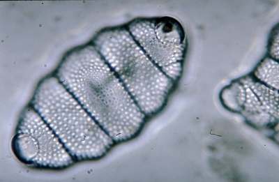 Biddulphia pulchella