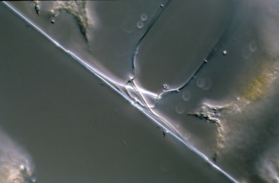 Biddulphia sinensis