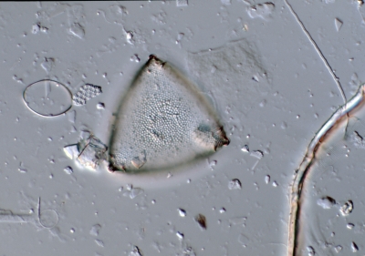 Biddulphia rhombus f.trigona